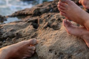 Caring For Your Sunburnt Feet